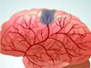 Cerebrovascular-Disease