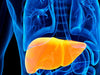 Fatty-Liver-Disease