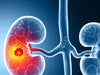 Kidney